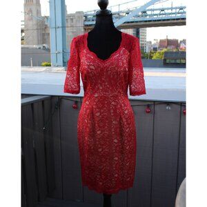 JAX V-Neck Scallop Hem Lace Dress